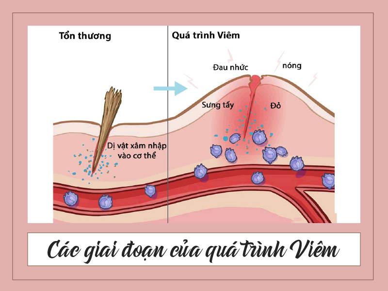 Các giai đoạn của quá trình viêm