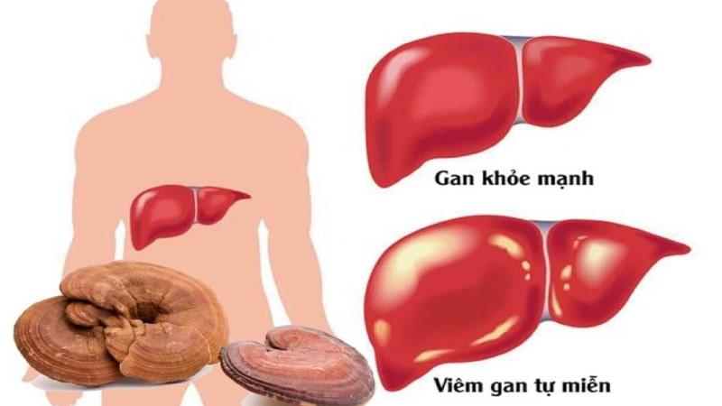 Nấm linh chi - Giải pháp cho bệnh gan B, xơ gan, gan nhiễm mỡ.