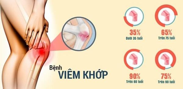 Ngũ Gia Bì hỗ trợ điều trị bệnh xương khớp